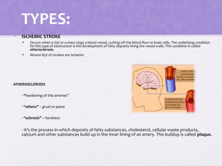 TYPES:
• ISCHEMIC STROKE
• Occurs when a clot or a mass clogs a blood vessel, cutting off the blood flow to brain cells. The underlying condition
for this type of obstruction is the development of fatty deposits lining the vessel walls. This condition is called
atherosclerosis.
• Almost 85% of strokes are ischemic
ATHEROSCLEROSIS
- “hardening of the arteries”
- “athero” – gruel or paste
- “sclerosis” – hardness
- It’s the process in which deposits of fatty substances, cholesterol, cellular waste products,
calcium and other substances build up in the inner lining of an artery. This buildup is called plaque.
 