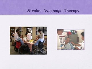 Stroke- Dysphagia Therapy
 