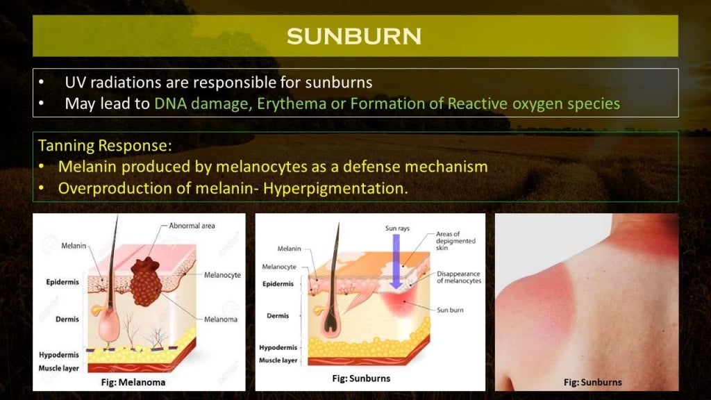 PRINCIPLES OF SUN PROTECTION Classification and Formulations of Sun…