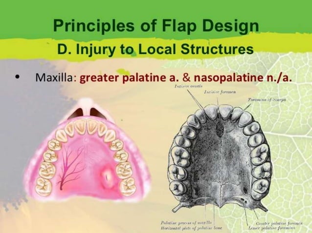 Principles of suture and flap design | PPTX