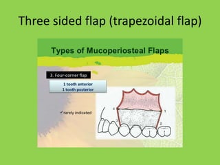 Trapezoidal Incision Principles of suture and flap design | PPTX