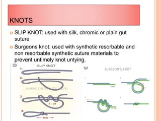 KNOTS
 SLIP KNOT: used with silk, chromic or plain gut
suture
 Surgeons knot: used with synthetic resorbable and
non resorbable synthetic suture materials to
prevent untimely knot untying.
 