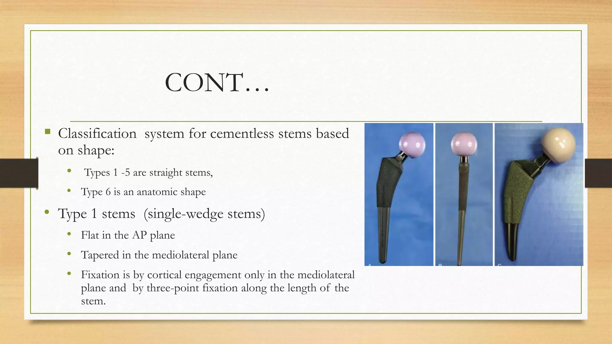 Principles Of Total Hip Replacement | PPTX