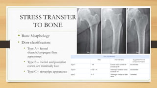 STRESS TRANSFER
TO BONE
 Bone Morphology
• Dorr classification:
• Type A – funnel
shape/champagne flute
appearance
• Type B – medial and posterior
cortex are minimally lost
• Type C – stovepipe appearance
 
