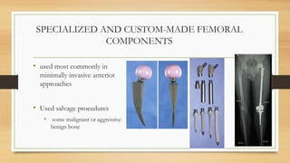SPECIALIZED AND CUSTOM-MADE FEMORAL
COMPONENTS
• used most commonly in
minimally invasive anterior
approaches
• Used salvage procedures
• some malignant or aggressive
benign bone
 