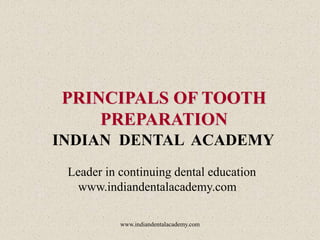 PRINCIPALS OF TOOTH
PREPARATION
INDIAN DENTAL ACADEMY
Leader in continuing dental education
www.indiandentalacademy.com
www.indiandentalacademy.com

 