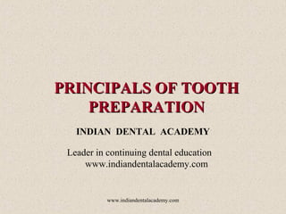 PRINCIPALS OF TOOTHPRINCIPALS OF TOOTH
PREPARATIONPREPARATION
INDIAN DENTAL ACADEMY
Leader in continuing dental education
www.indiandentalacademy.com
www.indiandentalacademy.com
 