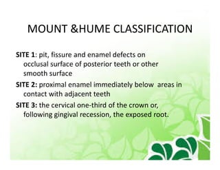 Mount Home Classification System Principles of tooth preparation | PDF