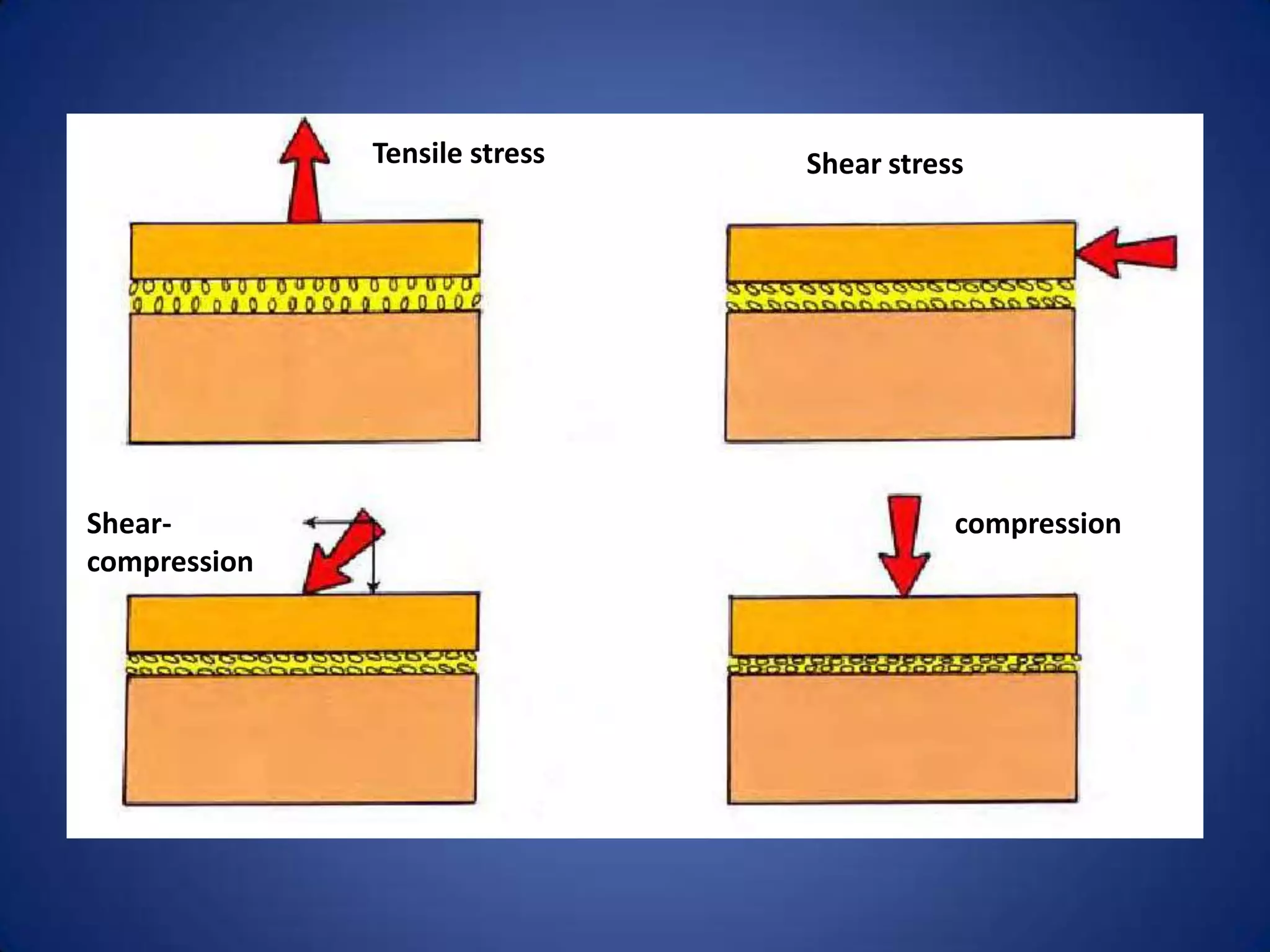 Tensile stress

Shearcompression

Shear stress

compression

 