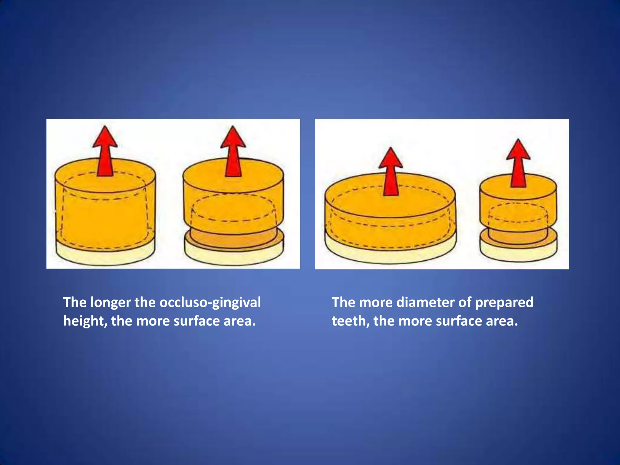 The longer the occluso-gingival
height, the more surface area.

The more diameter of prepared
teeth, the more surface area.

 