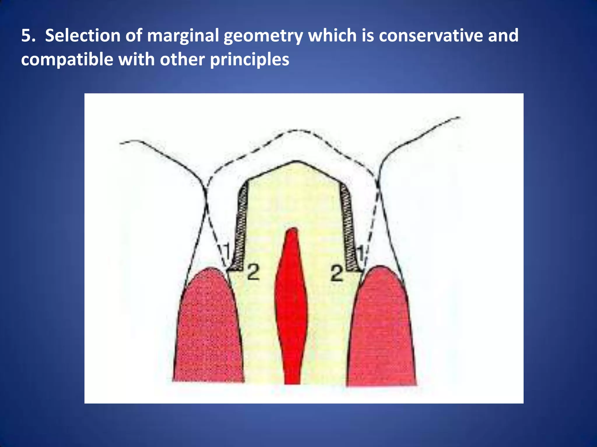 5. Selection of marginal geometry which is conservative and
compatible with other principles

 