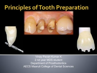 Vinay Pavan Kumar K
2 nd year MDS student
Department of Prosthodontics
AECS Maaruti College of Dental Sciences
 