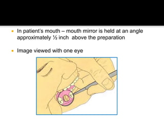 Principles of tooth preparation in Fixed Partial Dentures