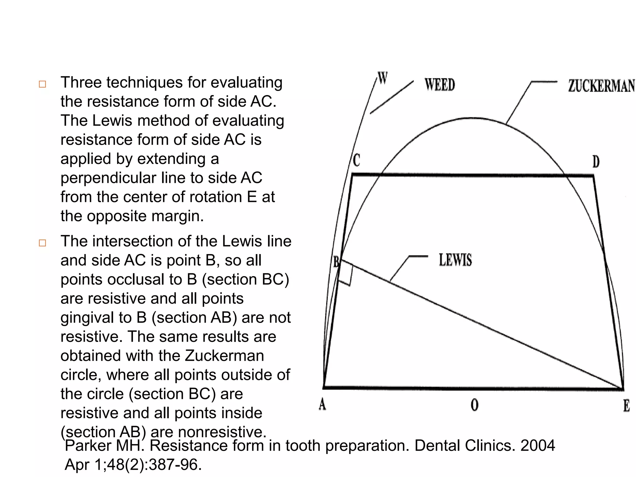  Three techniques for evaluating
the resistance form of side AC.
The Lewis method of evaluating
resistance form of side AC is
applied by extending a
perpendicular line to side AC
from the center of rotation E at
the opposite margin.
 The intersection of the Lewis line
and side AC is point B, so all
points occlusal to B (section BC)
are resistive and all points
gingival to B (section AB) are not
resistive. The same results are
obtained with the Zuckerman
circle, where all points outside of
the circle (section BC) are
resistive and all points inside
(section AB) are nonresistive.
Parker MH. Resistance form in tooth preparation. Dental Clinics. 2004
Apr 1;48(2):387-96.
 