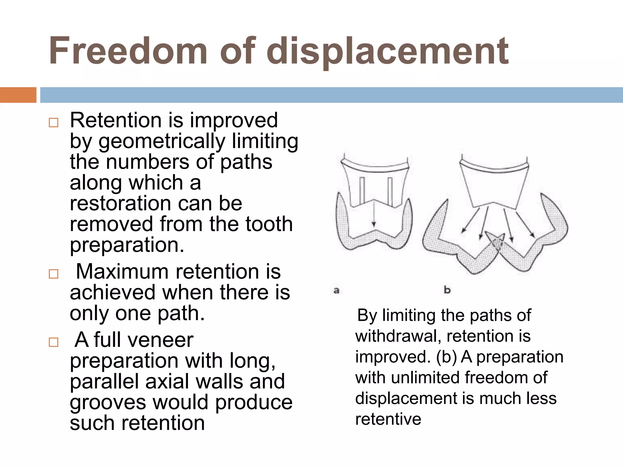 Freedom of displacement
 Retention is improved
by geometrically limiting
the numbers of paths
along which a
restoration can be
removed from the tooth
preparation.
 Maximum retention is
achieved when there is
only one path.
 A full veneer
preparation with long,
parallel axial walls and
grooves would produce
such retention
By limiting the paths of
withdrawal, retention is
improved. (b) A preparation
with unlimited freedom of
displacement is much less
retentive
 
