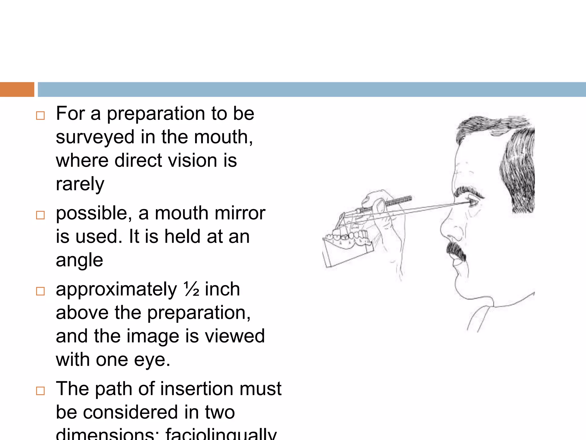  For a preparation to be
surveyed in the mouth,
where direct vision is
rarely
 possible, a mouth mirror
is used. It is held at an
angle
 approximately ½ inch
above the preparation,
and the image is viewed
with one eye.
 The path of insertion must
be considered in two
 