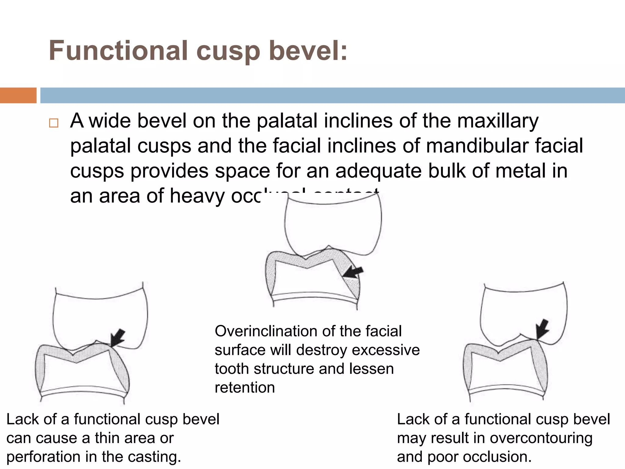 Functional cusp bevel:
 A wide bevel on the palatal inclines of the maxillary
palatal cusps and the facial inclines of mandibular facial
cusps provides space for an adequate bulk of metal in
an area of heavy occlusal contact.
Lack of a functional cusp bevel
can cause a thin area or
perforation in the casting.
Lack of a functional cusp bevel
may result in overcontouring
and poor occlusion.
Overinclination of the facial
surface will destroy excessive
tooth structure and lessen
retention
 