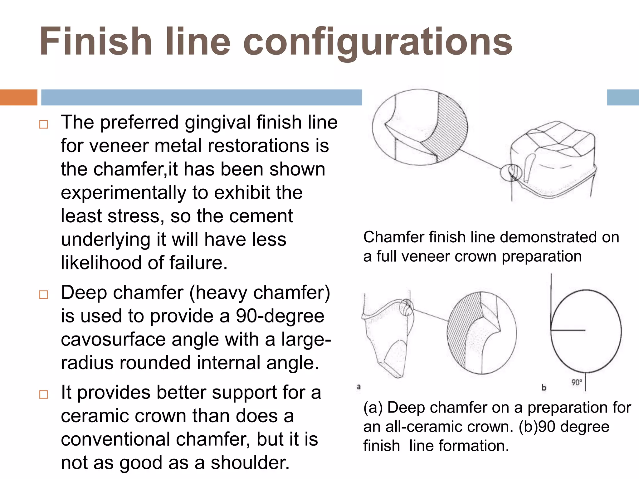 Finish line configurations
 The preferred gingival finish line
for veneer metal restorations is
the chamfer,it has been shown
experimentally to exhibit the
least stress, so the cement
underlying it will have less
likelihood of failure.
 Deep chamfer (heavy chamfer)
is used to provide a 90-degree
cavosurface angle with a large-
radius rounded internal angle.
 It provides better support for a
ceramic crown than does a
conventional chamfer, but it is
not as good as a shoulder.
Chamfer finish line demonstrated on
a full veneer crown preparation
(a) Deep chamfer on a preparation for
an all-ceramic crown. (b)90 degree
finish line formation.
 
