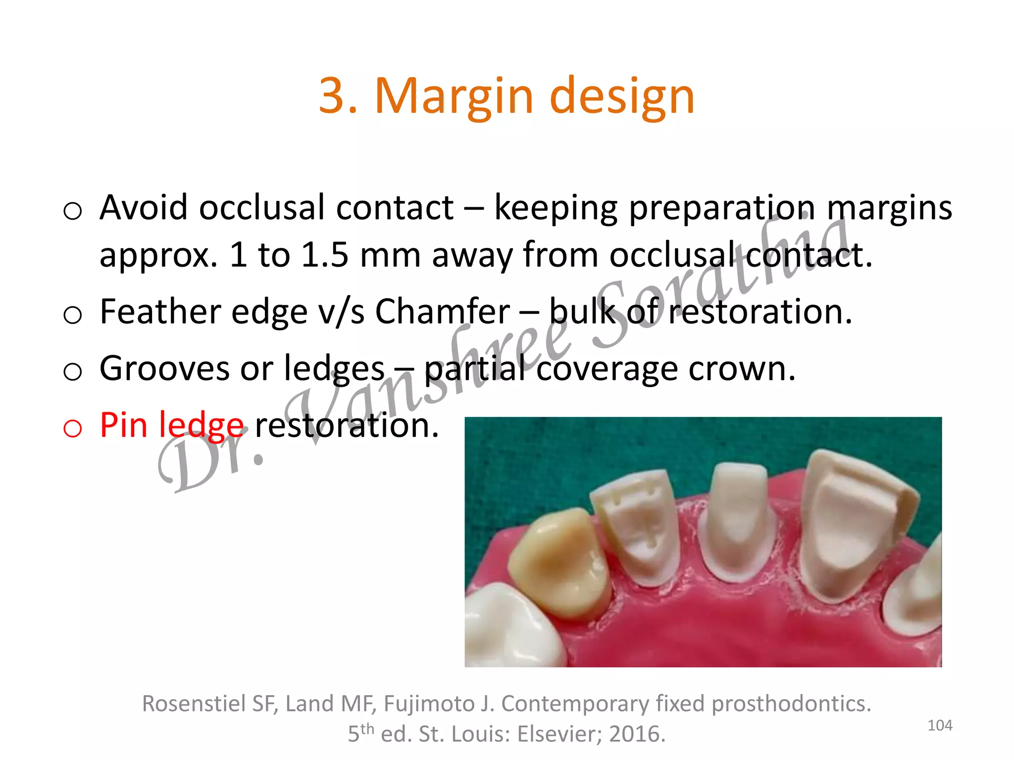 3. Margin design
o Avoid occlusal contact – keeping preparation margins
approx. 1 to 1.5 mm away from occlusal contact.
o Feather edge v/s Chamfer – bulk of restoration.
o Grooves or ledges – partial coverage crown.
o Pin ledge restoration.
Rosenstiel SF, Land MF, Fujimoto J. Contemporary fixed prosthodontics.
5th ed. St. Louis: Elsevier; 2016. 104
 