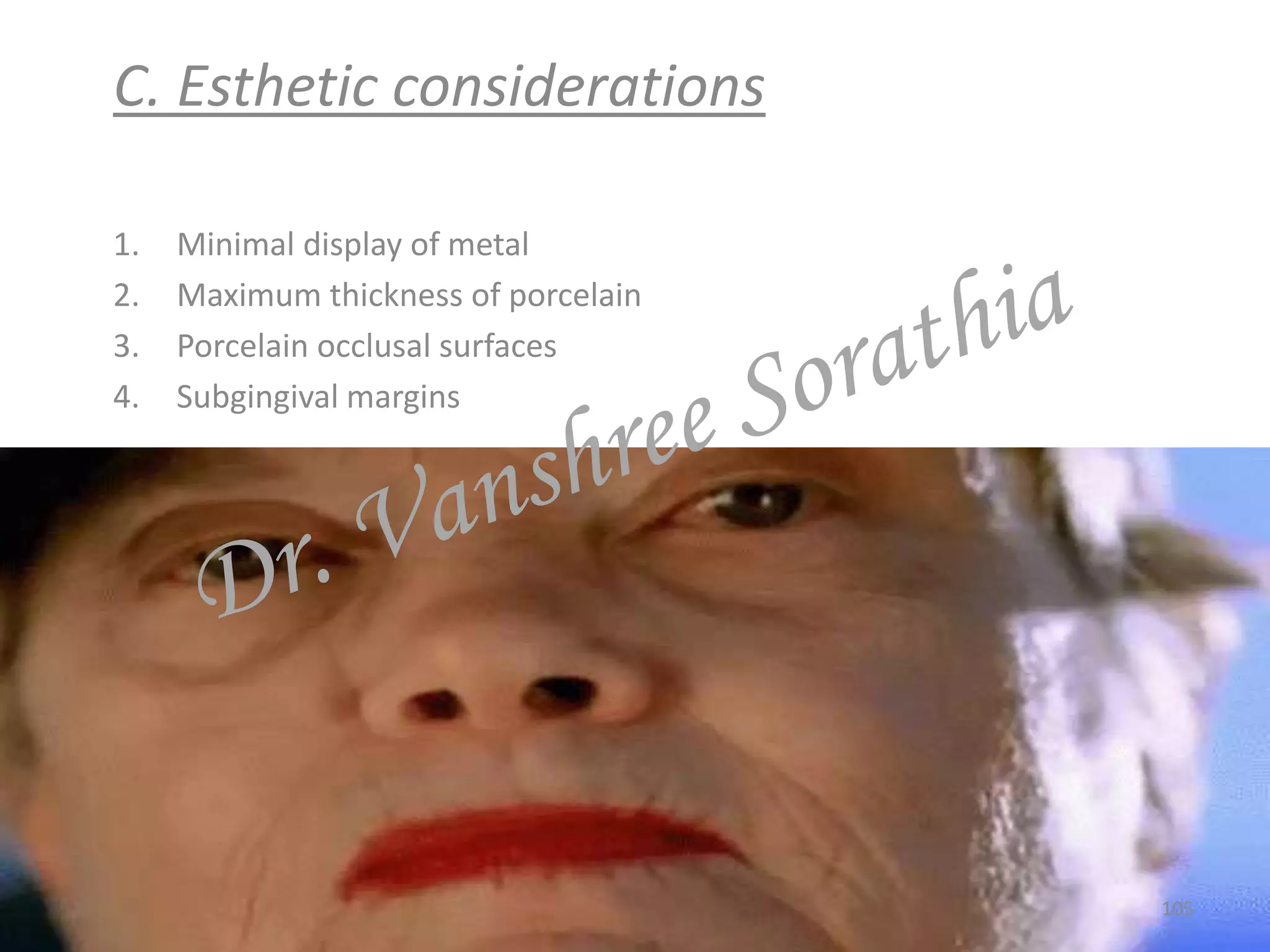 C. Esthetic considerations
1. Minimal display of metal
2. Maximum thickness of porcelain
3. Porcelain occlusal surfaces
4. Subgingival margins
105
 