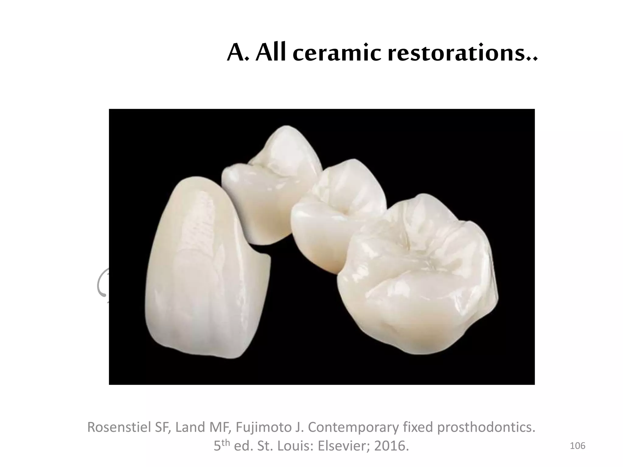 A. All ceramic restorations..
106
Rosenstiel SF, Land MF, Fujimoto J. Contemporary fixed prosthodontics.
5th ed. St. Louis: Elsevier; 2016.
 