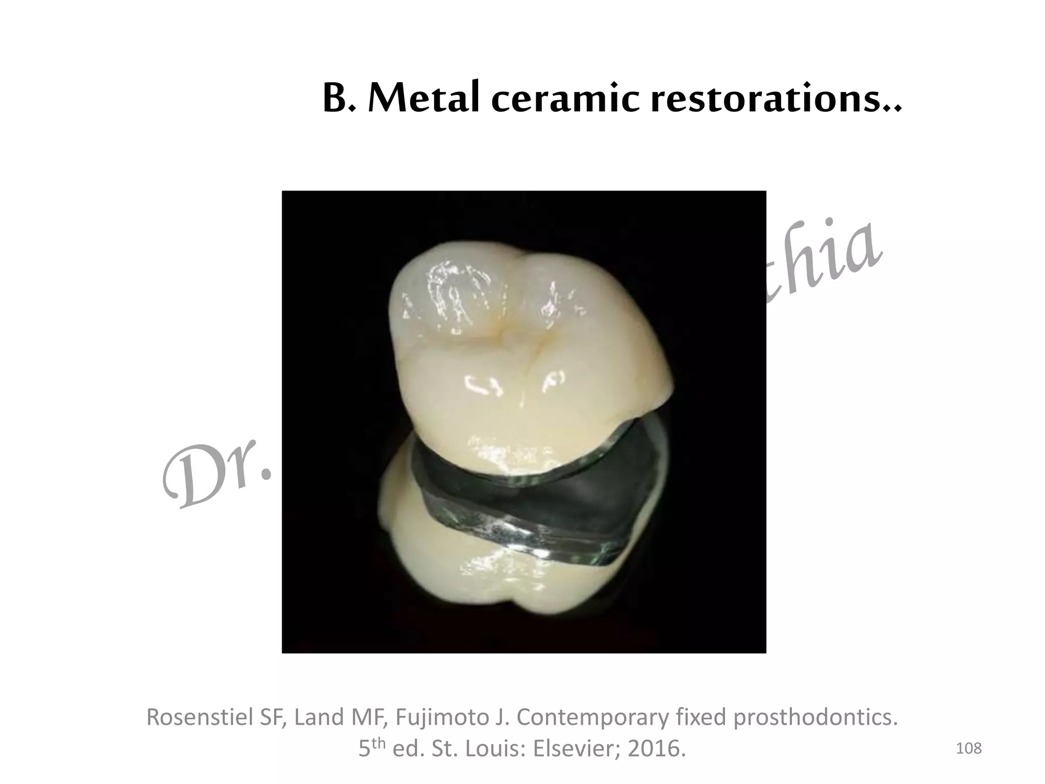 B. Metal ceramic restorations..
108
Rosenstiel SF, Land MF, Fujimoto J. Contemporary fixed prosthodontics.
5th ed. St. Louis: Elsevier; 2016.
 