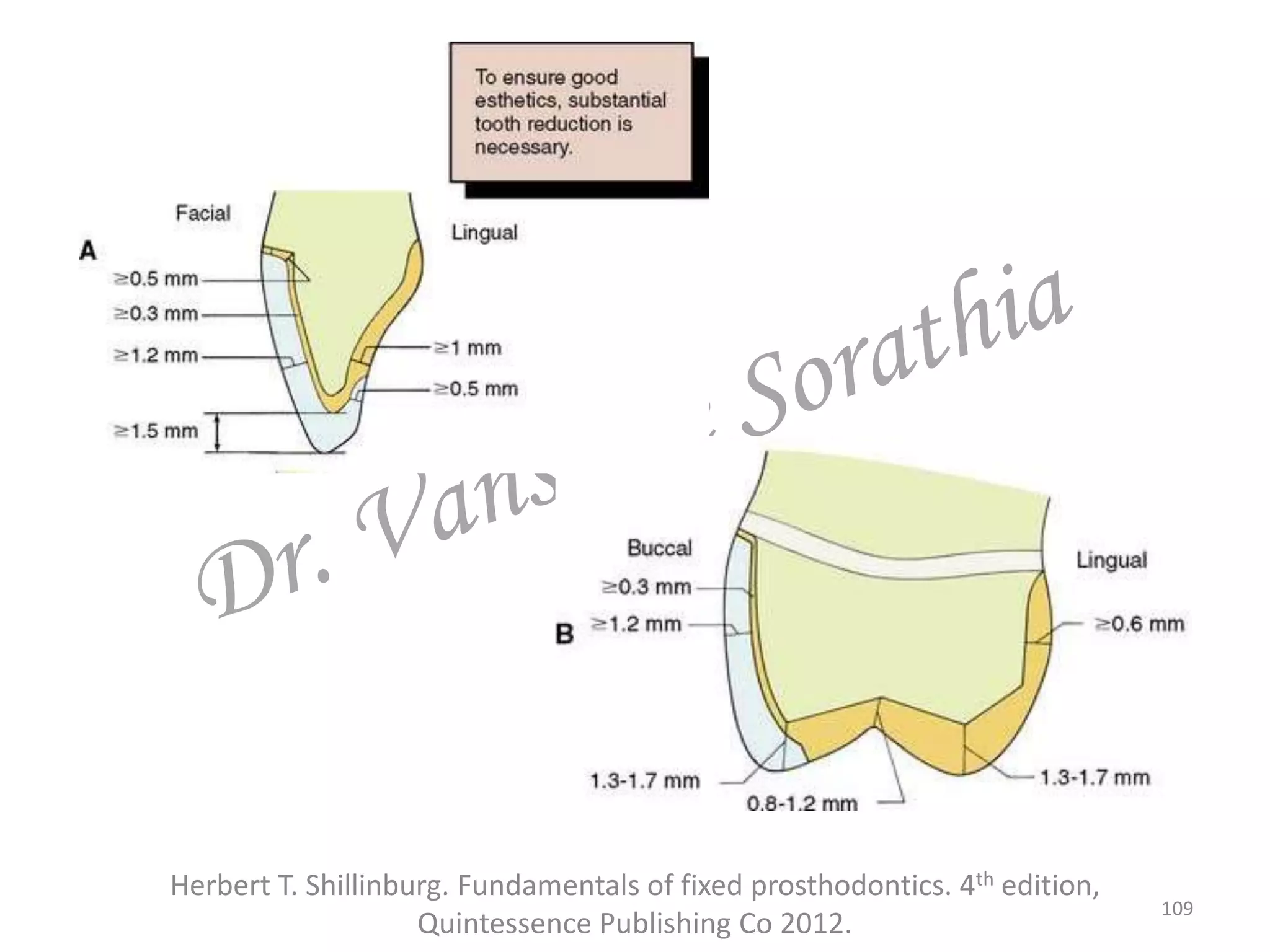 Herbert T. Shillinburg. Fundamentals of fixed prosthodontics. 4th edition,
Quintessence Publishing Co 2012.
109
 