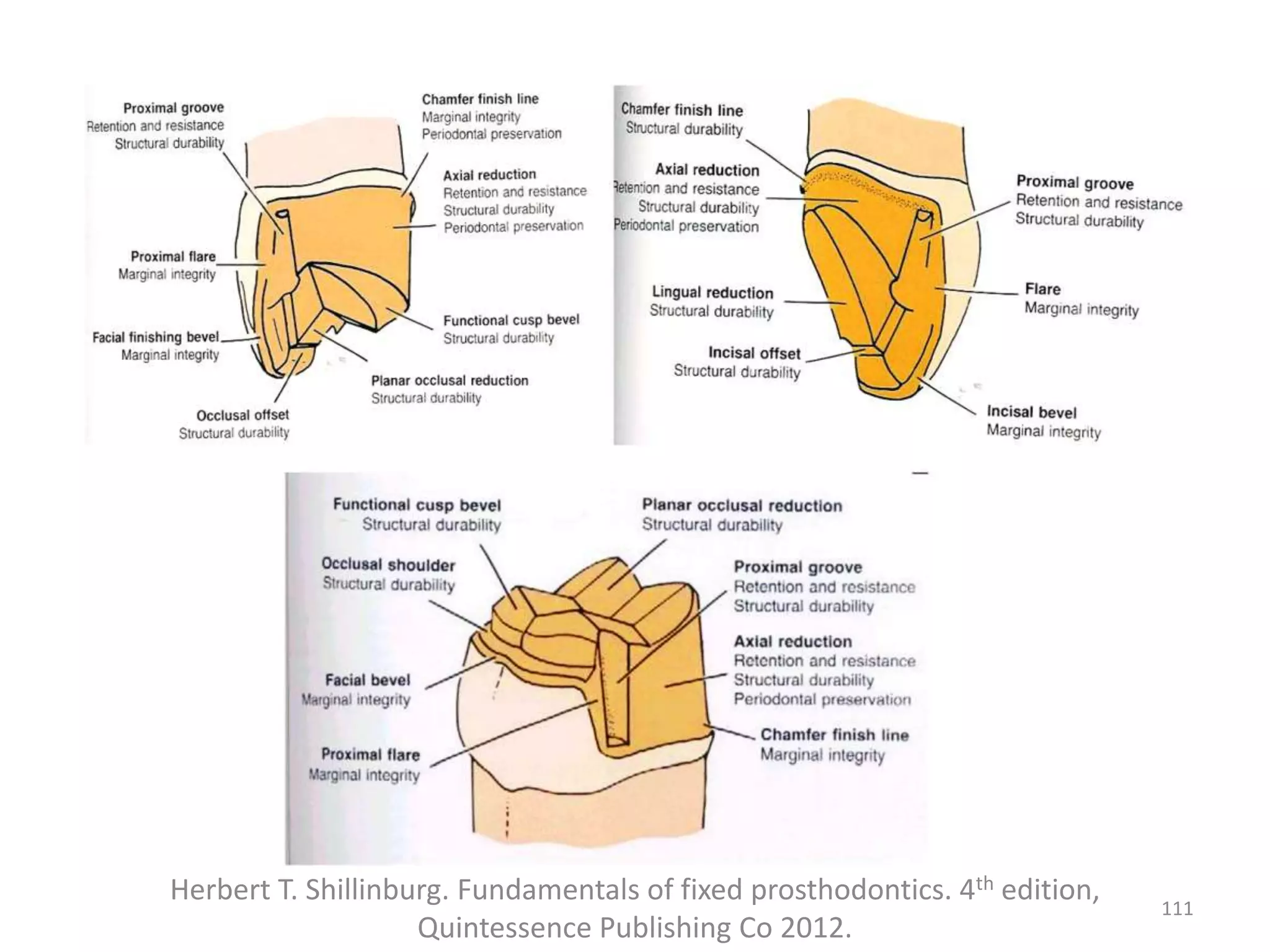 Herbert T. Shillinburg. Fundamentals of fixed prosthodontics. 4th edition,
Quintessence Publishing Co 2012.
111
 