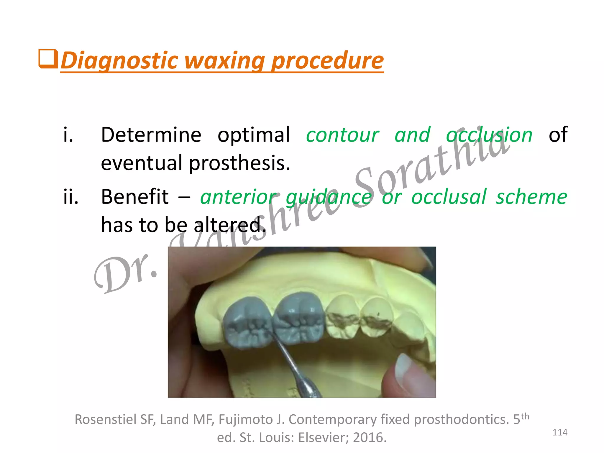 Diagnostic waxing procedure
i. Determine optimal contour and occlusion of
eventual prosthesis.
ii. Benefit – anterior guidance or occlusal scheme
has to be altered.
114
Rosenstiel SF, Land MF, Fujimoto J. Contemporary fixed prosthodontics. 5th
ed. St. Louis: Elsevier; 2016.
 