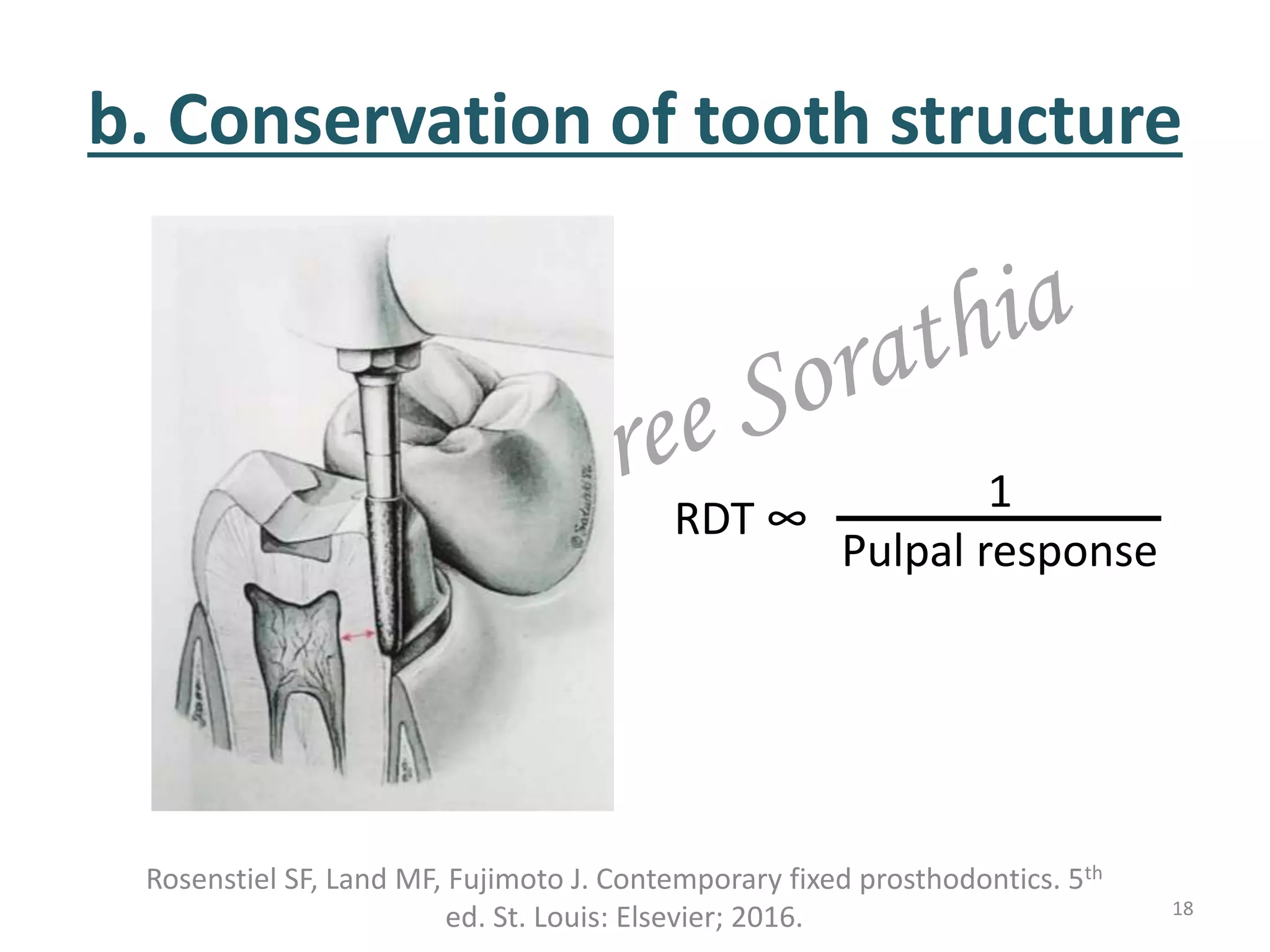 b. Conservation of tooth structure
18
RDT ∞
1
Pulpal response
Rosenstiel SF, Land MF, Fujimoto J. Contemporary fixed prosthodontics. 5th
ed. St. Louis: Elsevier; 2016.
 