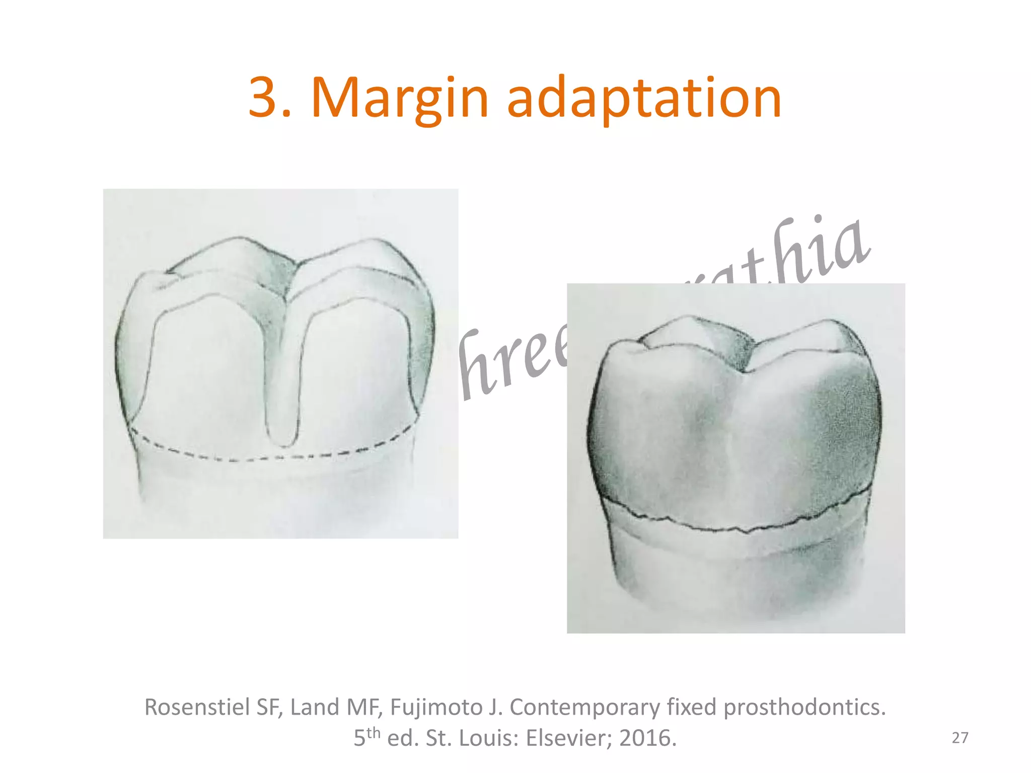3. Margin adaptation
27
Rosenstiel SF, Land MF, Fujimoto J. Contemporary fixed prosthodontics.
5th ed. St. Louis: Elsevier; 2016.
 