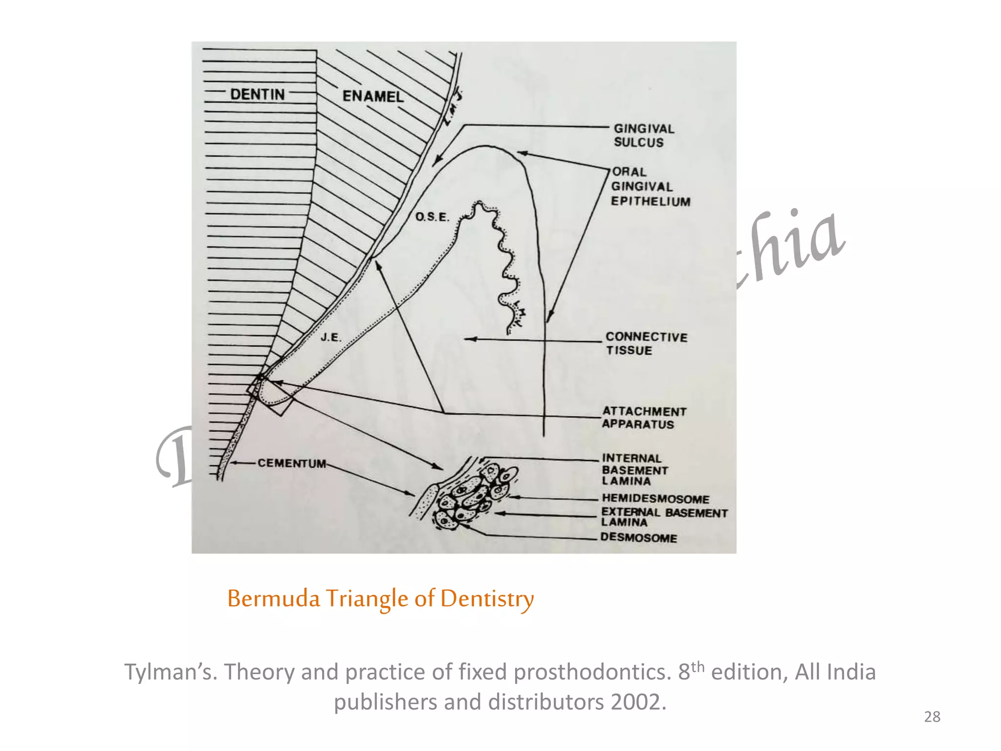 Tylman’s. Theory and practice of fixed prosthodontics. 8th edition, All India
publishers and distributors 2002. 28
Bermuda Triangle of Dentistry
 