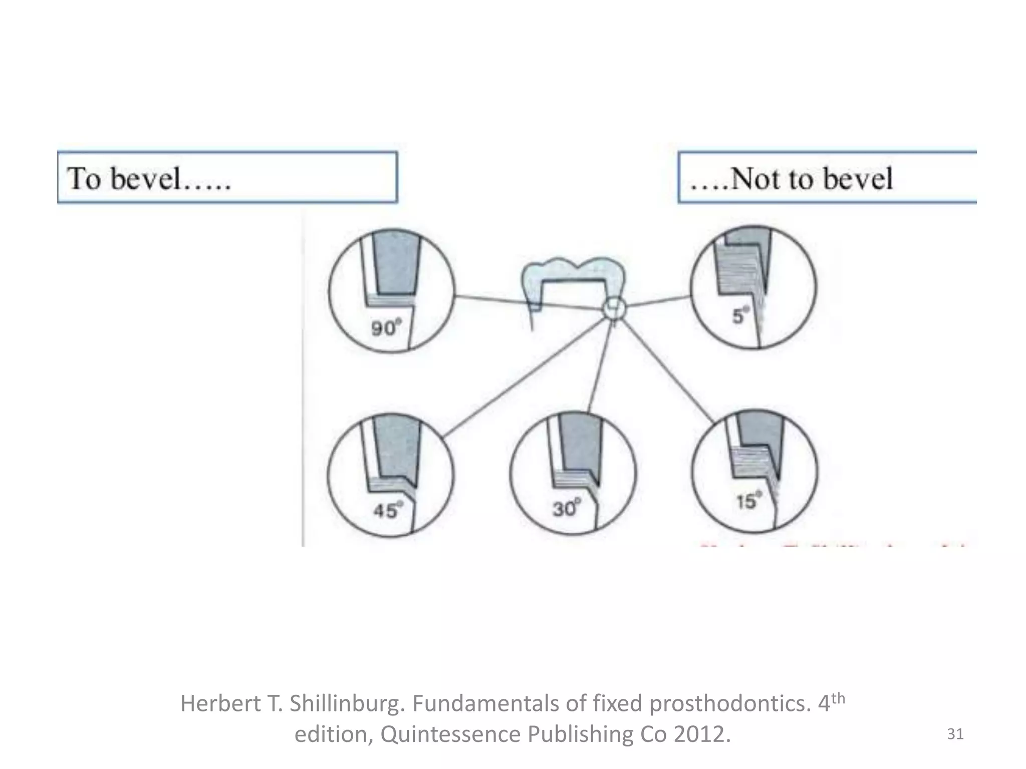 31
Herbert T. Shillinburg. Fundamentals of fixed prosthodontics. 4th
edition, Quintessence Publishing Co 2012.
 