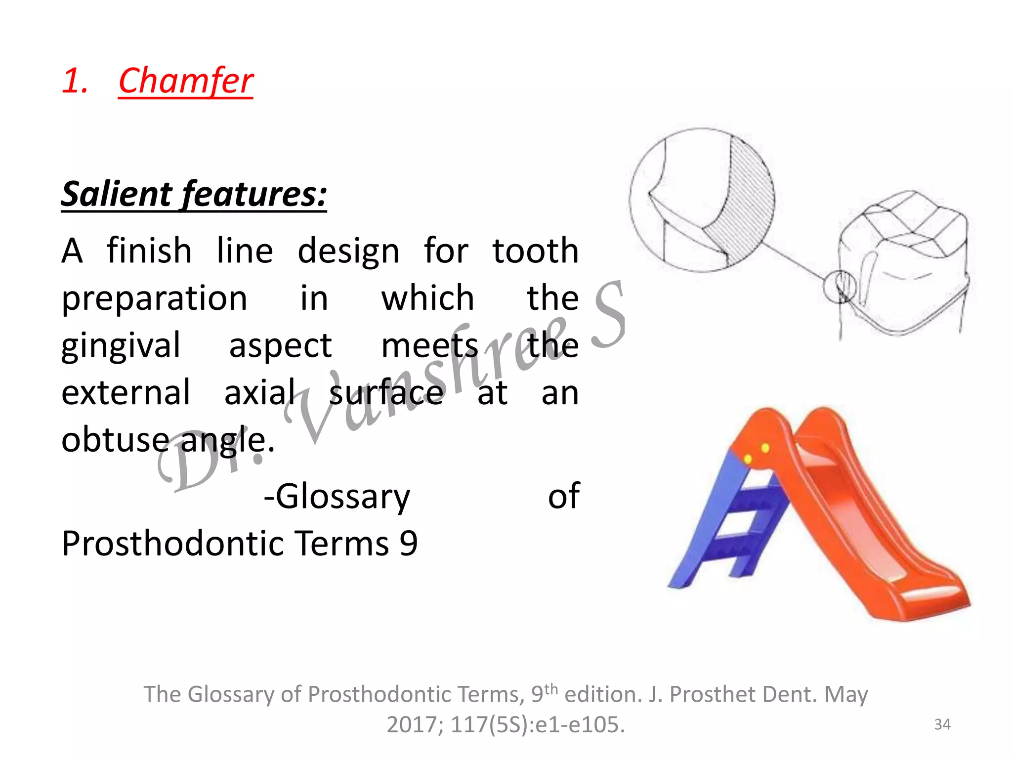 1. Chamfer
Salient features:
A finish line design for tooth
preparation in which the
gingival aspect meets the
external axial surface at an
obtuse angle.
-Glossary of
Prosthodontic Terms 9
34
The Glossary of Prosthodontic Terms, 9th edition. J. Prosthet Dent. May
2017; 117(5S):e1-e105.
 