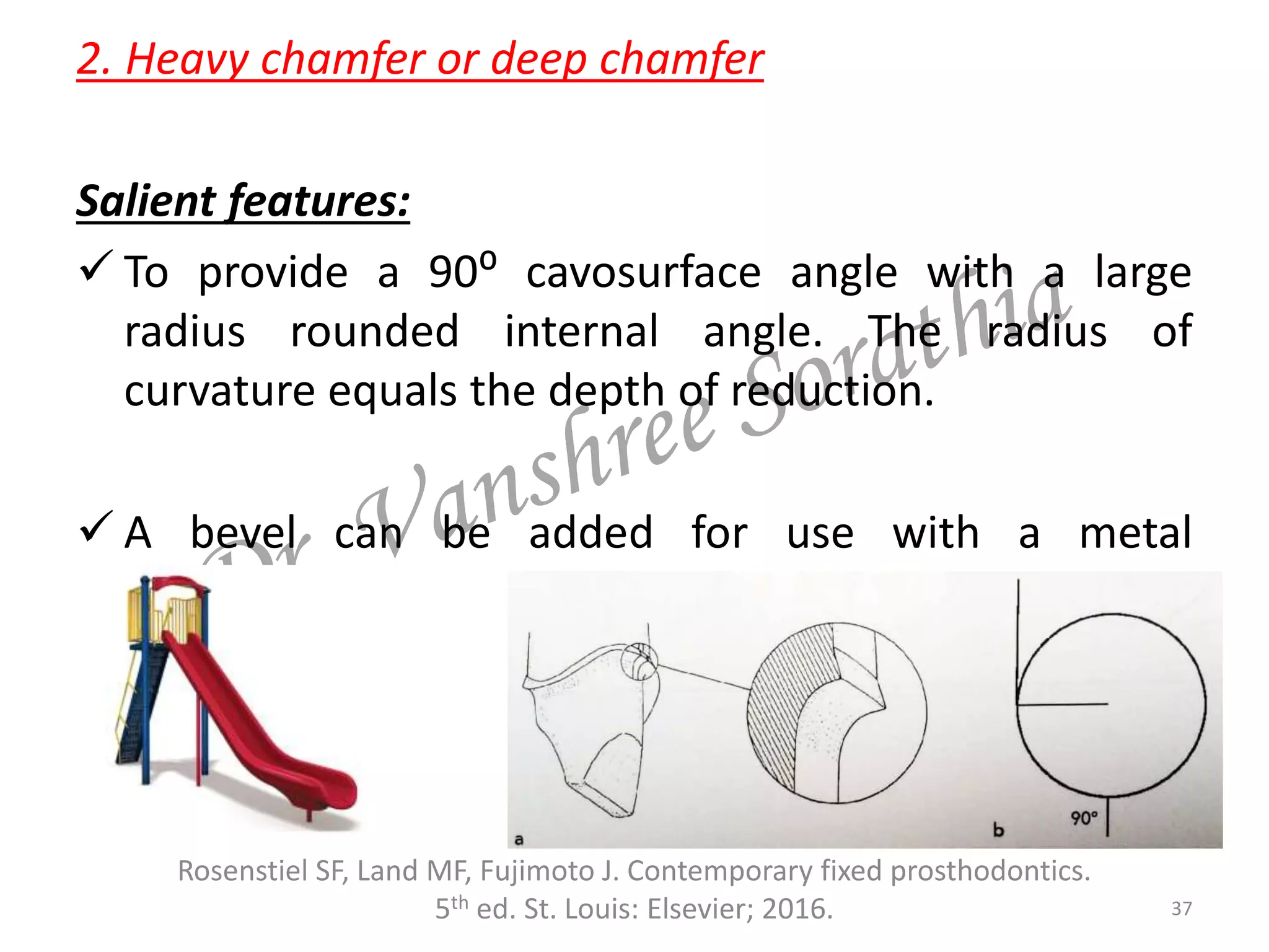2. Heavy chamfer or deep chamfer
Salient features:
 To provide a 90⁰ cavosurface angle with a large
radius rounded internal angle. The radius of
curvature equals the depth of reduction.
 A bevel can be added for use with a metal
restoration.
37
Rosenstiel SF, Land MF, Fujimoto J. Contemporary fixed prosthodontics.
5th ed. St. Louis: Elsevier; 2016.
 