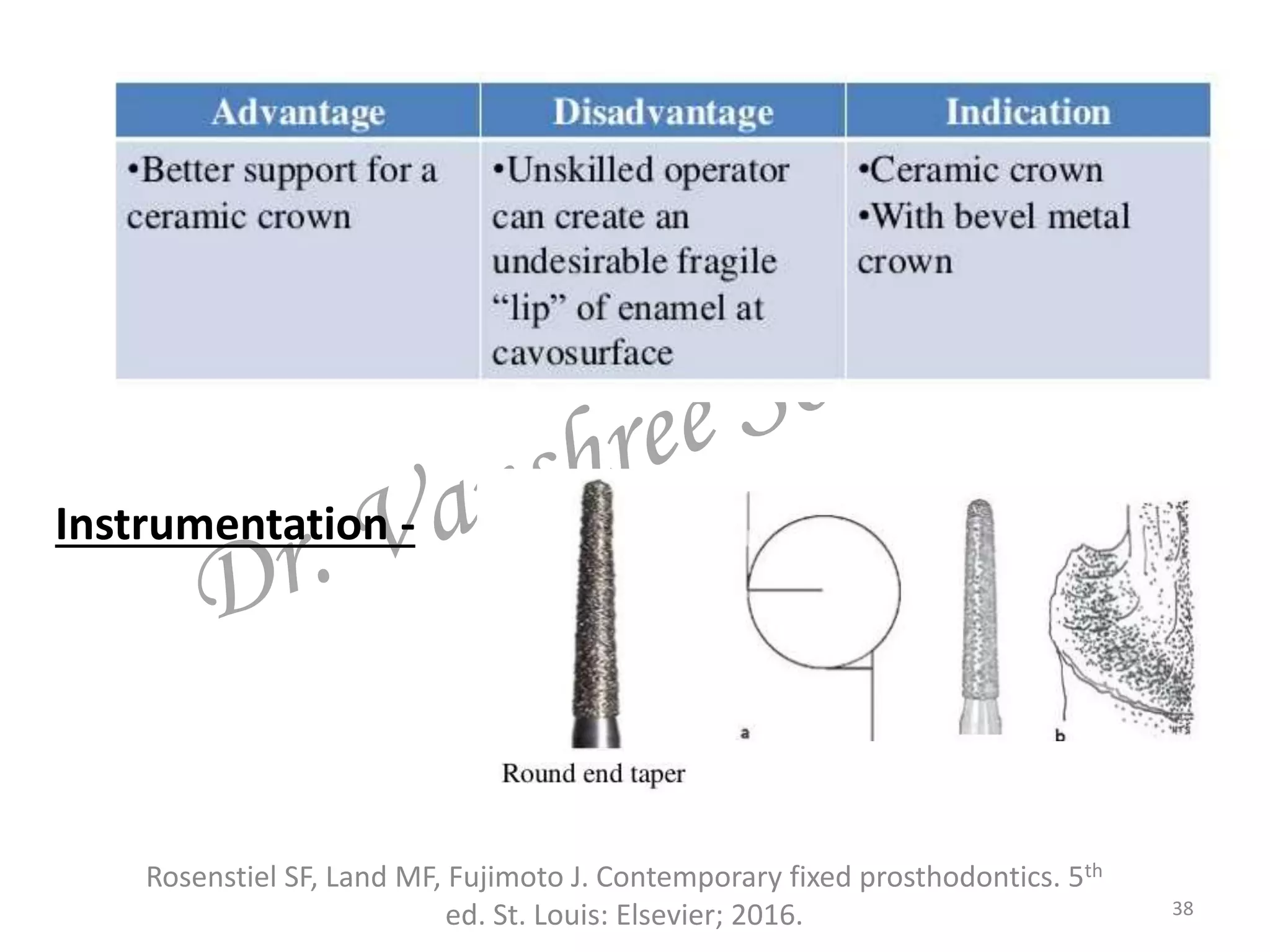 38
Instrumentation -
Rosenstiel SF, Land MF, Fujimoto J. Contemporary fixed prosthodontics. 5th
ed. St. Louis: Elsevier; 2016.
 