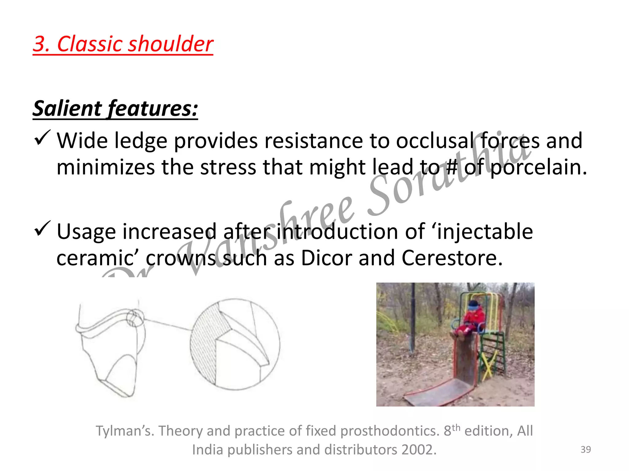 3. Classic shoulder
Salient features:
 Wide ledge provides resistance to occlusal forces and
minimizes the stress that might lead to # of porcelain.
 Usage increased after introduction of ‘injectable
ceramic’ crowns such as Dicor and Cerestore.
39
Tylman’s. Theory and practice of fixed prosthodontics. 8th edition, All
India publishers and distributors 2002.
 