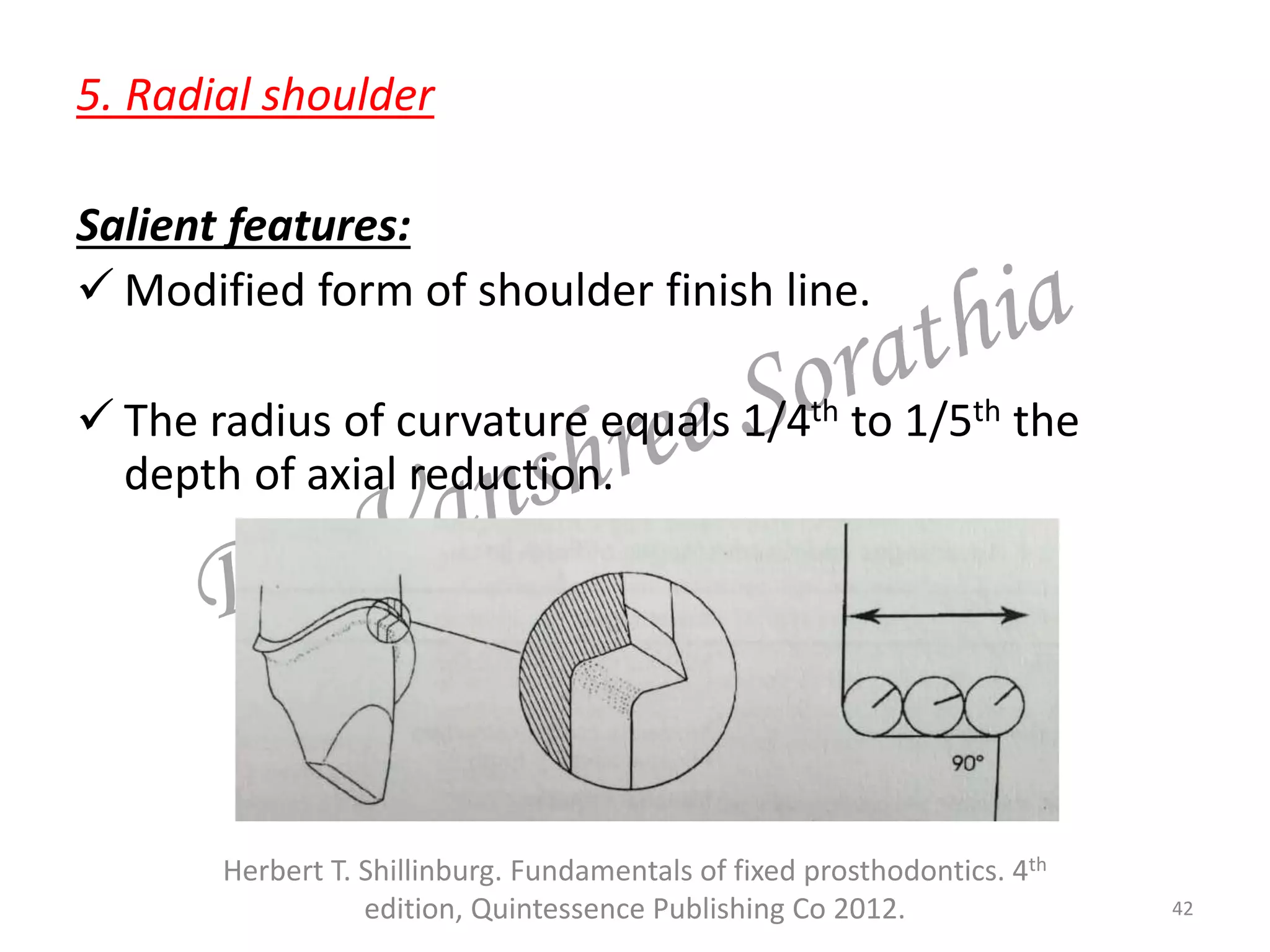 5. Radial shoulder
Salient features:
 Modified form of shoulder finish line.
 The radius of curvature equals 1/4th to 1/5th the
depth of axial reduction.
42
Herbert T. Shillinburg. Fundamentals of fixed prosthodontics. 4th
edition, Quintessence Publishing Co 2012.
 