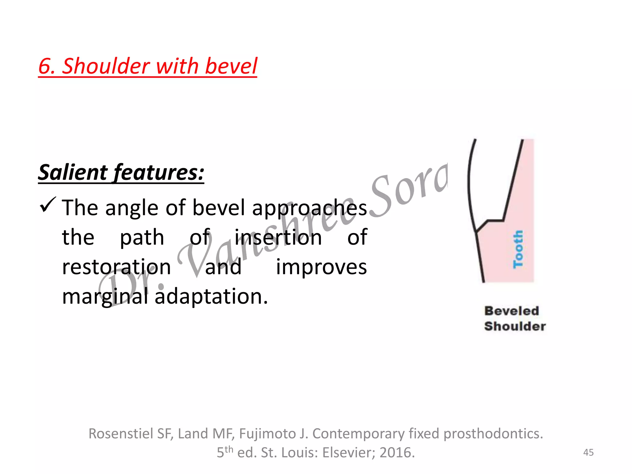 6. Shoulder with bevel
Salient features:
 The angle of bevel approaches
the path of insertion of
restoration and improves
marginal adaptation.
45
Rosenstiel SF, Land MF, Fujimoto J. Contemporary fixed prosthodontics.
5th ed. St. Louis: Elsevier; 2016.
 