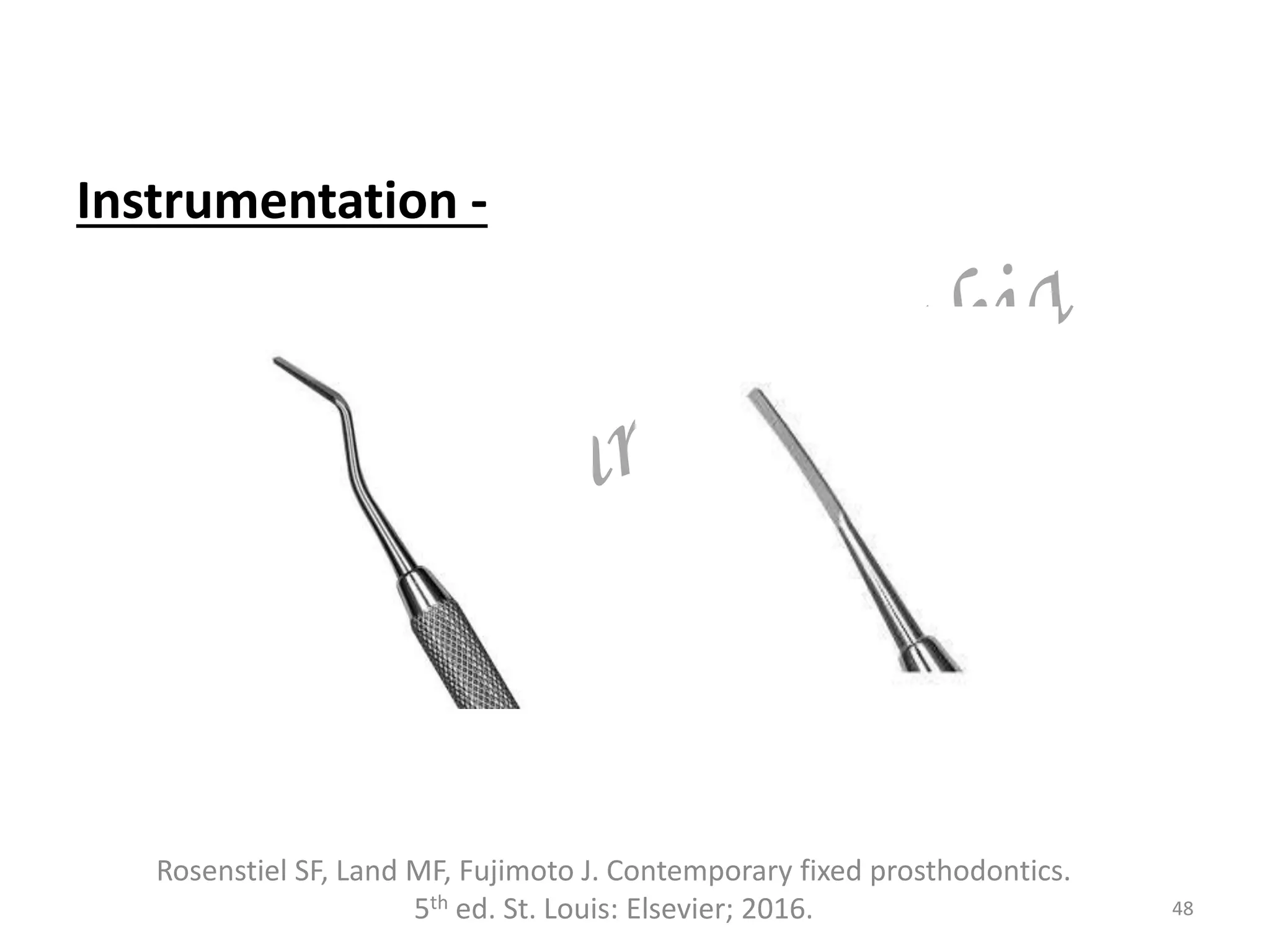 Instrumentation -
48
Rosenstiel SF, Land MF, Fujimoto J. Contemporary fixed prosthodontics.
5th ed. St. Louis: Elsevier; 2016.
 