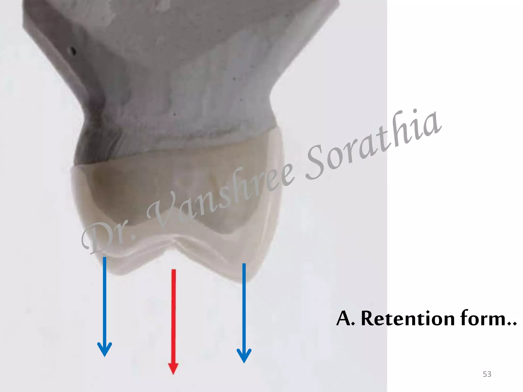 A. Retention form..
53
 
