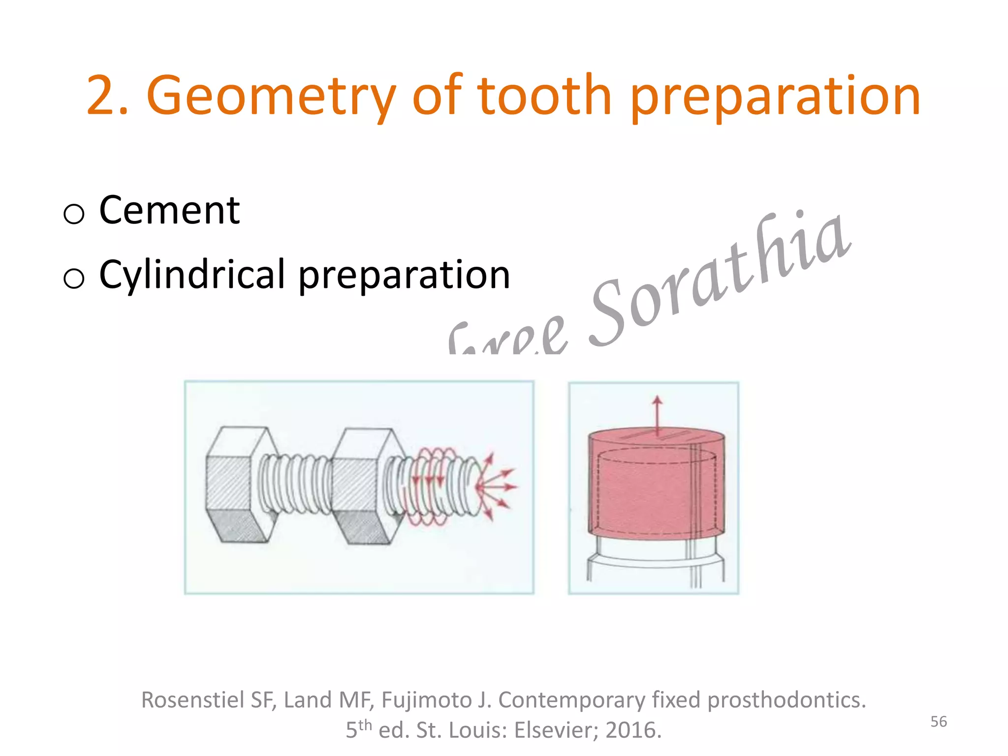 2. Geometry of tooth preparation
Rosenstiel SF, Land MF, Fujimoto J. Contemporary fixed prosthodontics.
5th ed. St. Louis: Elsevier; 2016. 56
o Cement
o Cylindrical preparation
 
