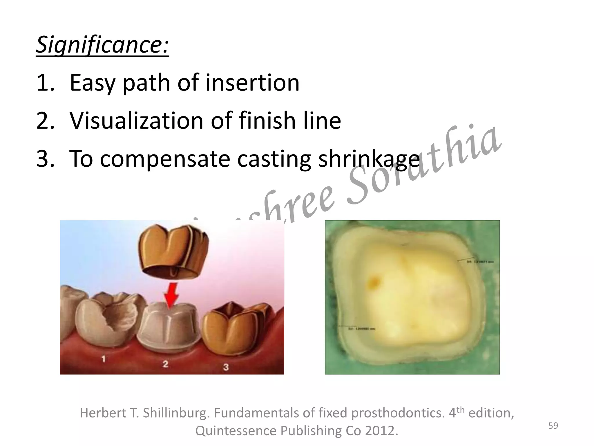 Significance:
1. Easy path of insertion
2. Visualization of finish line
3. To compensate casting shrinkage
59
Herbert T. Shillinburg. Fundamentals of fixed prosthodontics. 4th edition,
Quintessence Publishing Co 2012.
 