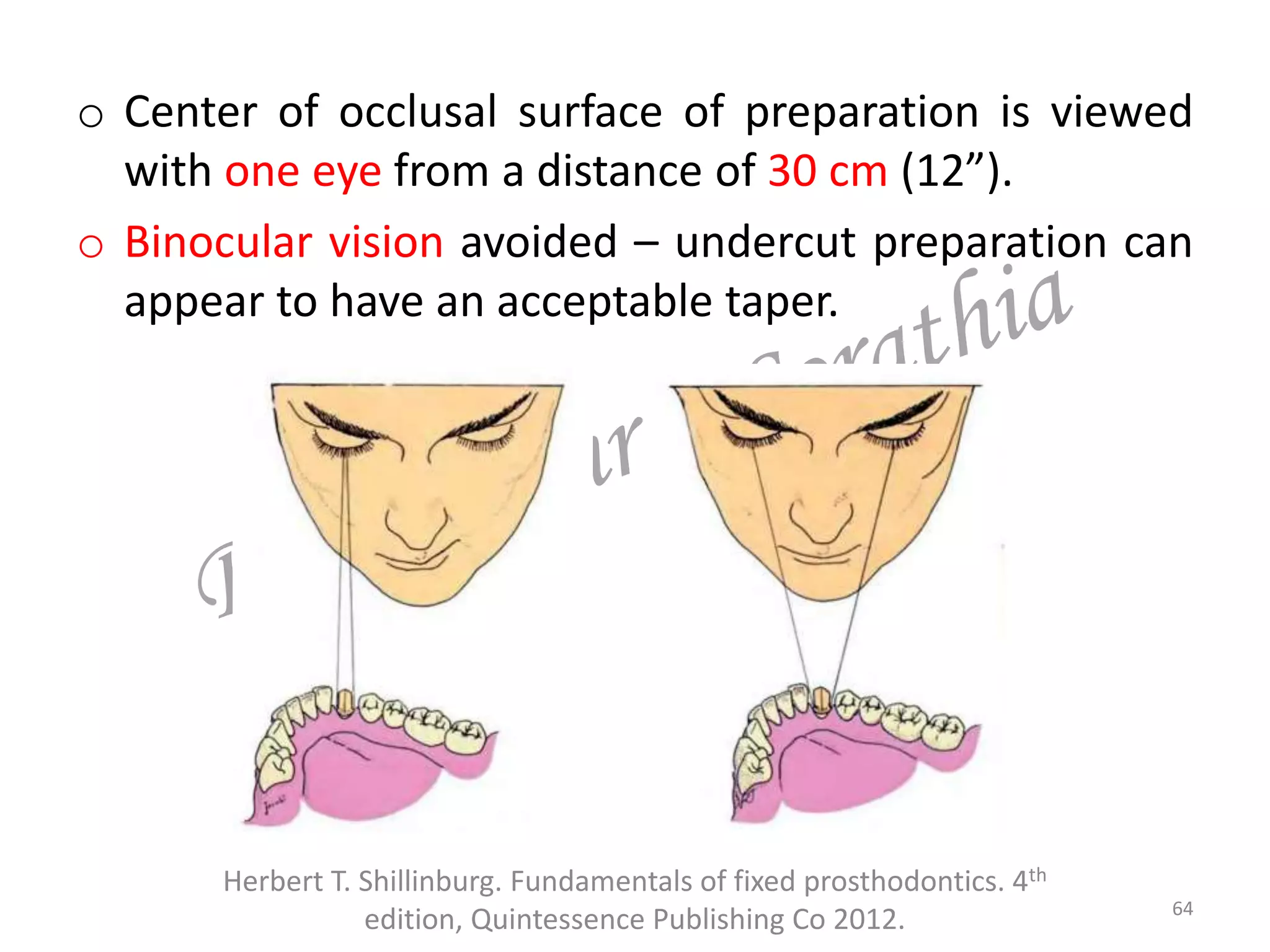 o Center of occlusal surface of preparation is viewed
with one eye from a distance of 30 cm (12”).
o Binocular vision avoided – undercut preparation can
appear to have an acceptable taper.
Herbert T. Shillinburg. Fundamentals of fixed prosthodontics. 4th
edition, Quintessence Publishing Co 2012. 64
 