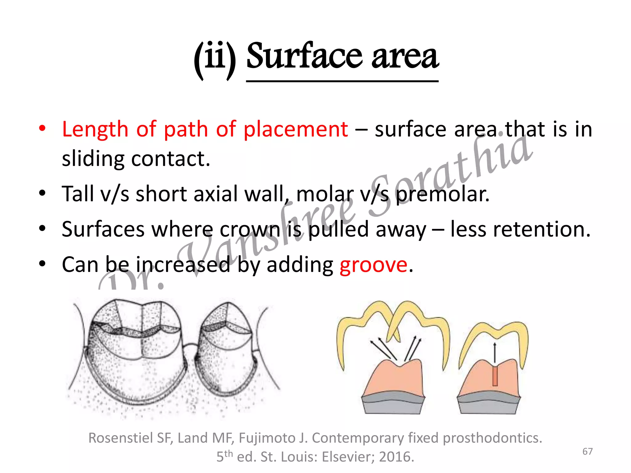 (ii) Surface area
Rosenstiel SF, Land MF, Fujimoto J. Contemporary fixed prosthodontics.
5th ed. St. Louis: Elsevier; 2016. 67
• Length of path of placement – surface area that is in
sliding contact.
• Tall v/s short axial wall, molar v/s premolar.
• Surfaces where crown is pulled away – less retention.
• Can be increased by adding groove.
 