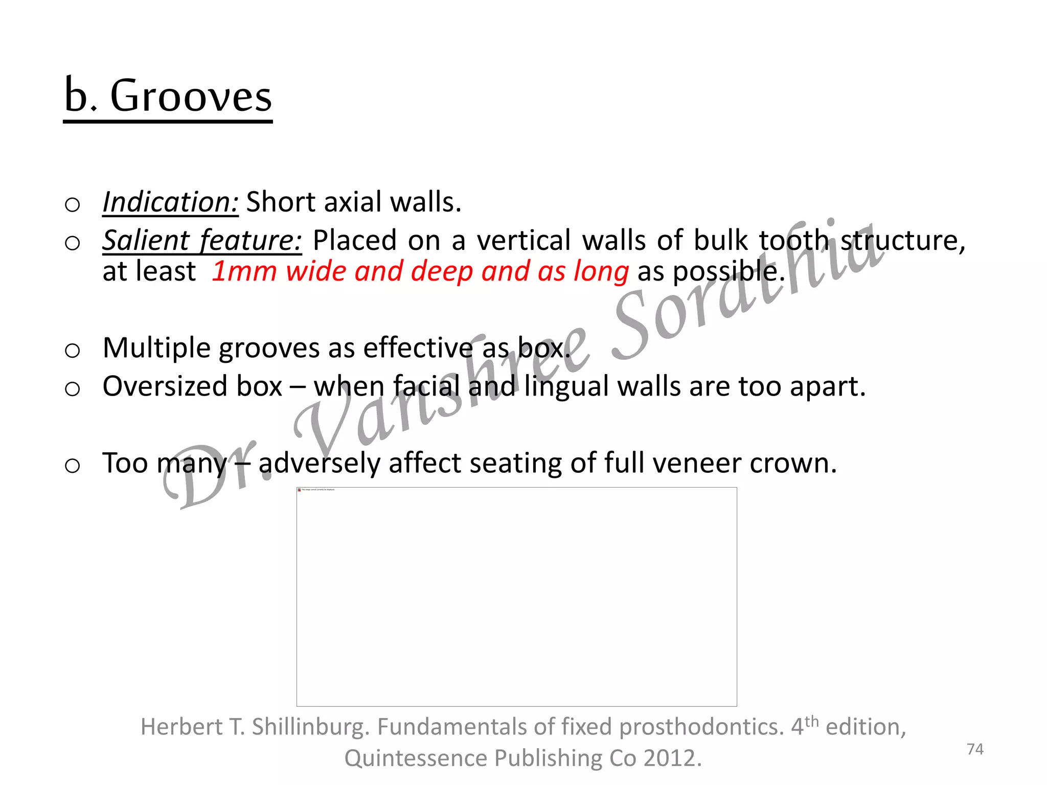 b. Grooves
o Indication: Short axial walls.
o Salient feature: Placed on a vertical walls of bulk tooth structure,
at least 1mm wide and deep and as long as possible.
o Multiple grooves as effective as box.
o Oversized box – when facial and lingual walls are too apart.
o Too many – adversely affect seating of full veneer crown.
74
Herbert T. Shillinburg. Fundamentals of fixed prosthodontics. 4th edition,
Quintessence Publishing Co 2012.
 