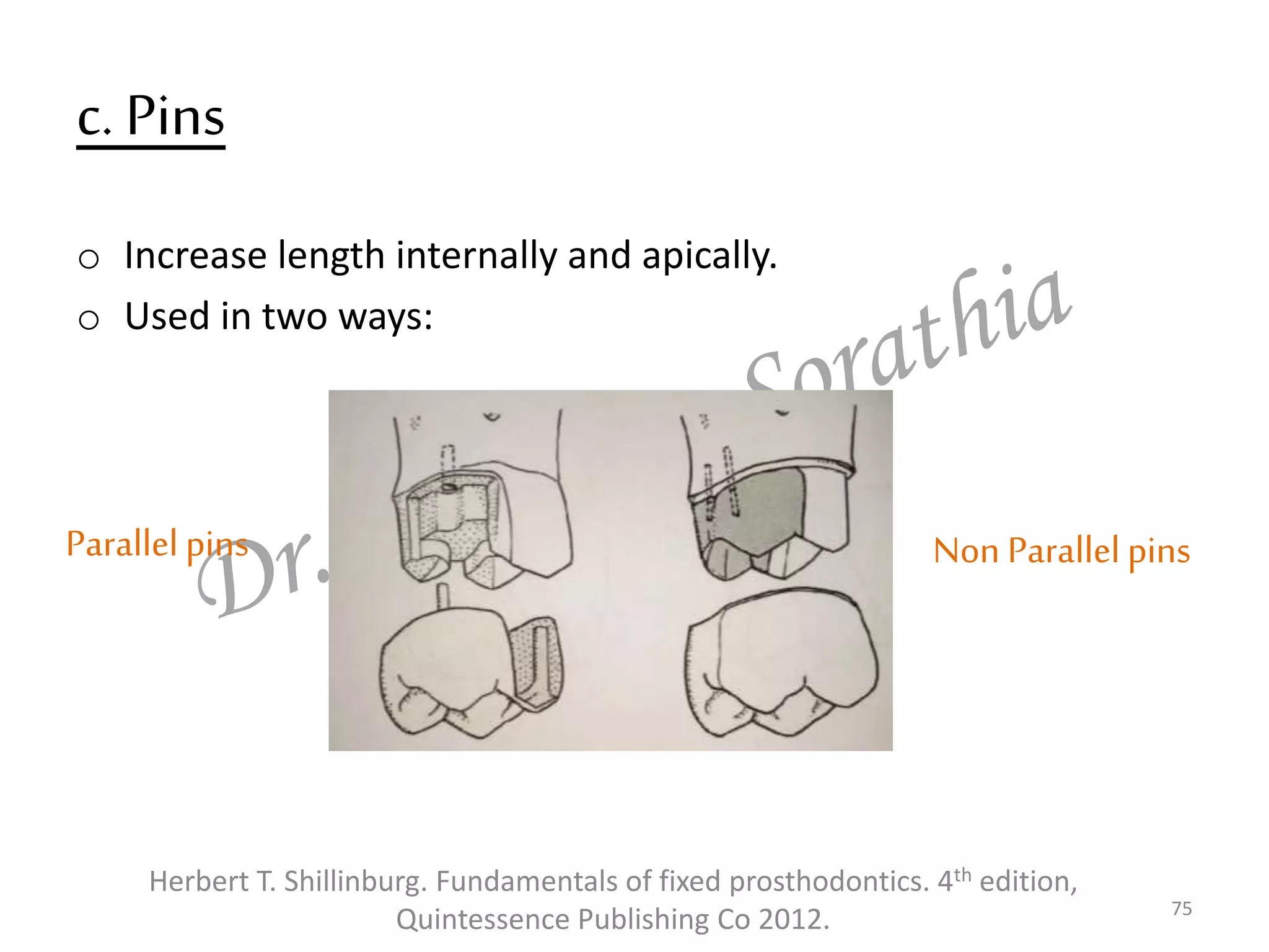 c. Pins
o Increase length internally and apically.
o Used in two ways:
75
Herbert T. Shillinburg. Fundamentals of fixed prosthodontics. 4th edition,
Quintessence Publishing Co 2012.
Parallel pins Non Parallel pins
 