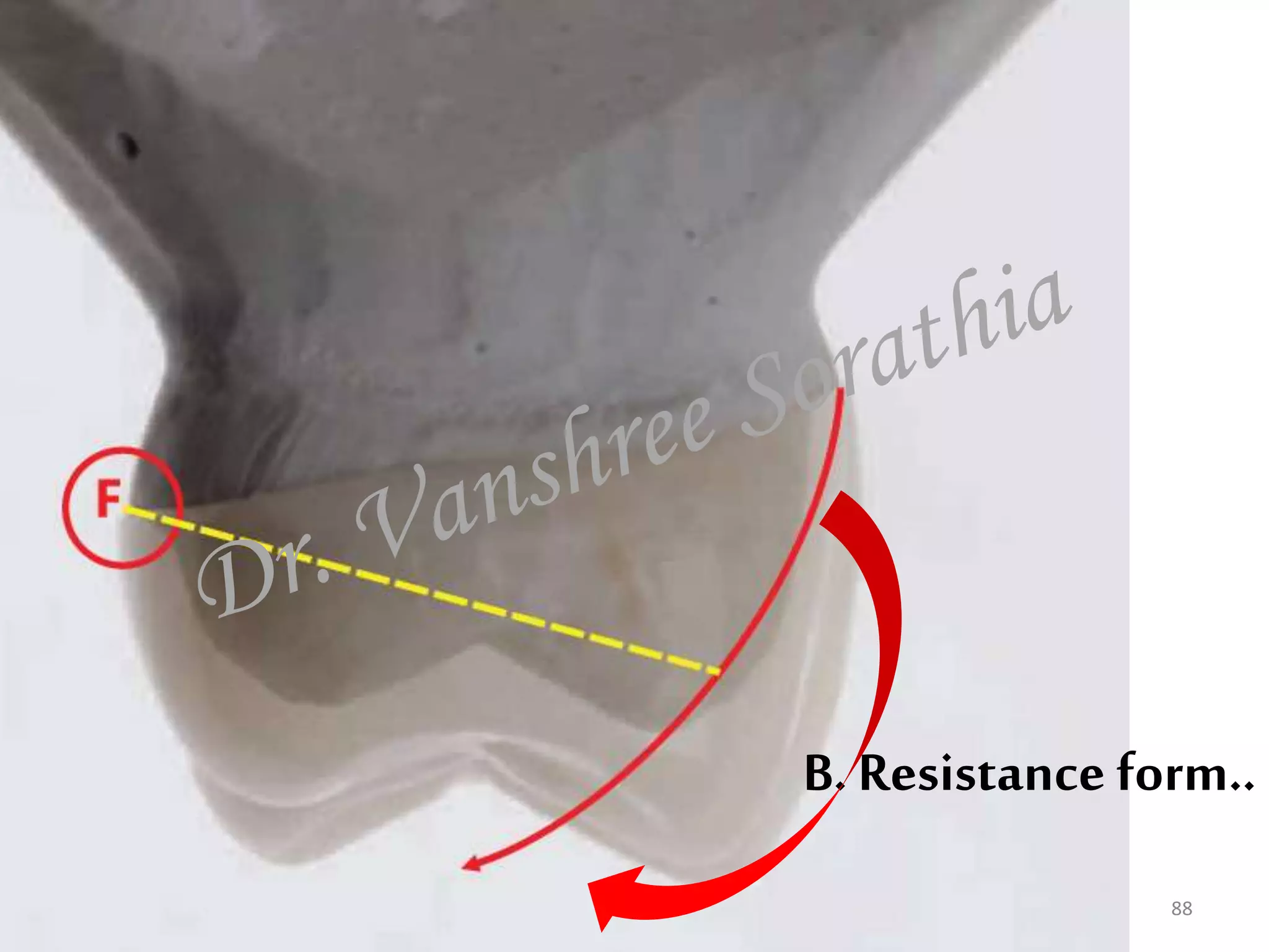B. Resistance form..
88
 