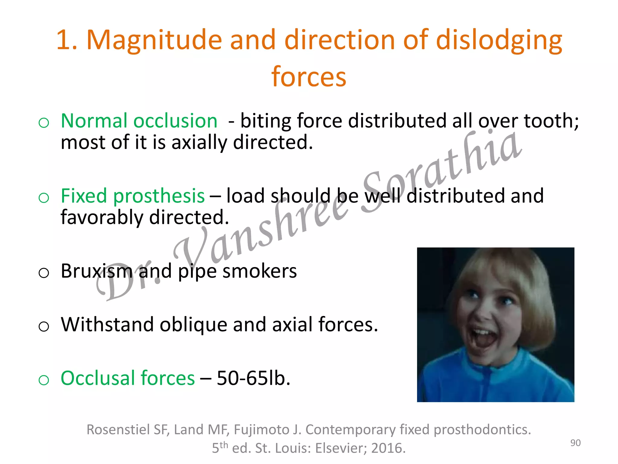 1. Magnitude and direction of dislodging
forces
o Normal occlusion - biting force distributed all over tooth;
most of it is axially directed.
o Fixed prosthesis – load should be well distributed and
favorably directed.
o Bruxism and pipe smokers
o Withstand oblique and axial forces.
o Occlusal forces – 50-65lb.
Rosenstiel SF, Land MF, Fujimoto J. Contemporary fixed prosthodontics.
5th ed. St. Louis: Elsevier; 2016. 90
 