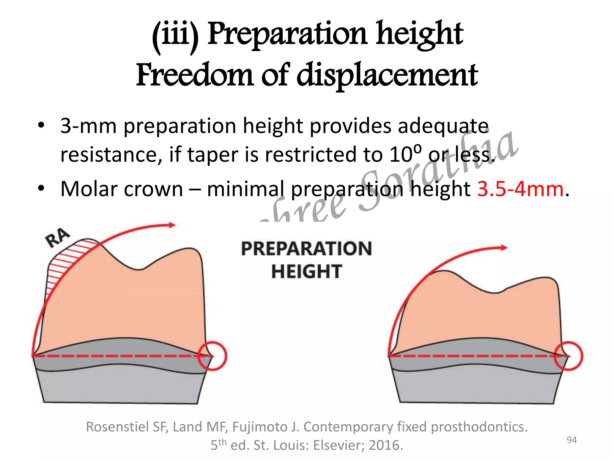 (iii) Preparation height
Freedom of displacement
Rosenstiel SF, Land MF, Fujimoto J. Contemporary fixed prosthodontics.
5th ed. St. Louis: Elsevier; 2016. 94
• 3-mm preparation height provides adequate
resistance, if taper is restricted to 10⁰ or less.
• Molar crown – minimal preparation height 3.5-4mm.
 